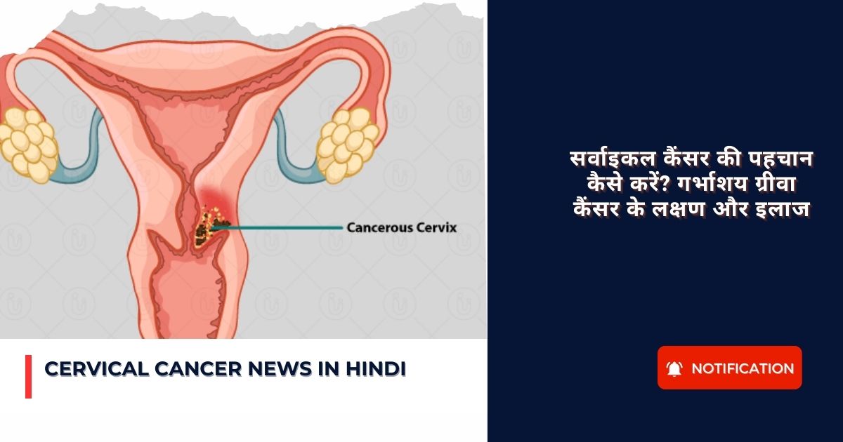 Cervical Cancer News in Hindi : सर्वाइकल कैंसर की पहचान कैसे करें? गर्भाशय ग्रीवा कैंसर के लक्षण और इलाज